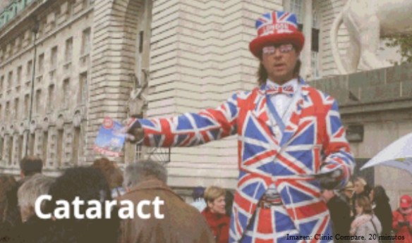 las cataratas y el glaucoma